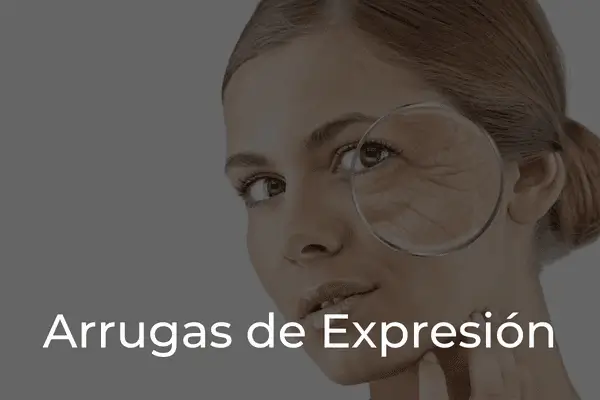 Arrugas de Expresión