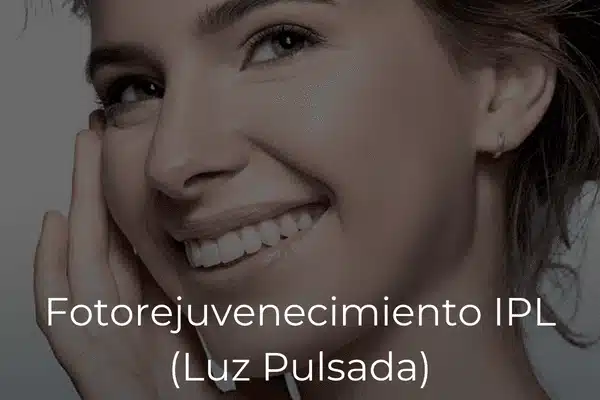 Fotorejuvenecimiento Facial IPL