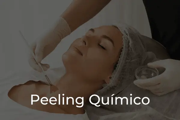 Peelings Químicos_Portada