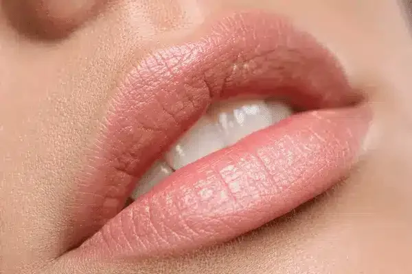 Tratamiento labios con ácido hialurónico Tratamiento de labios con ácido hialurónico
